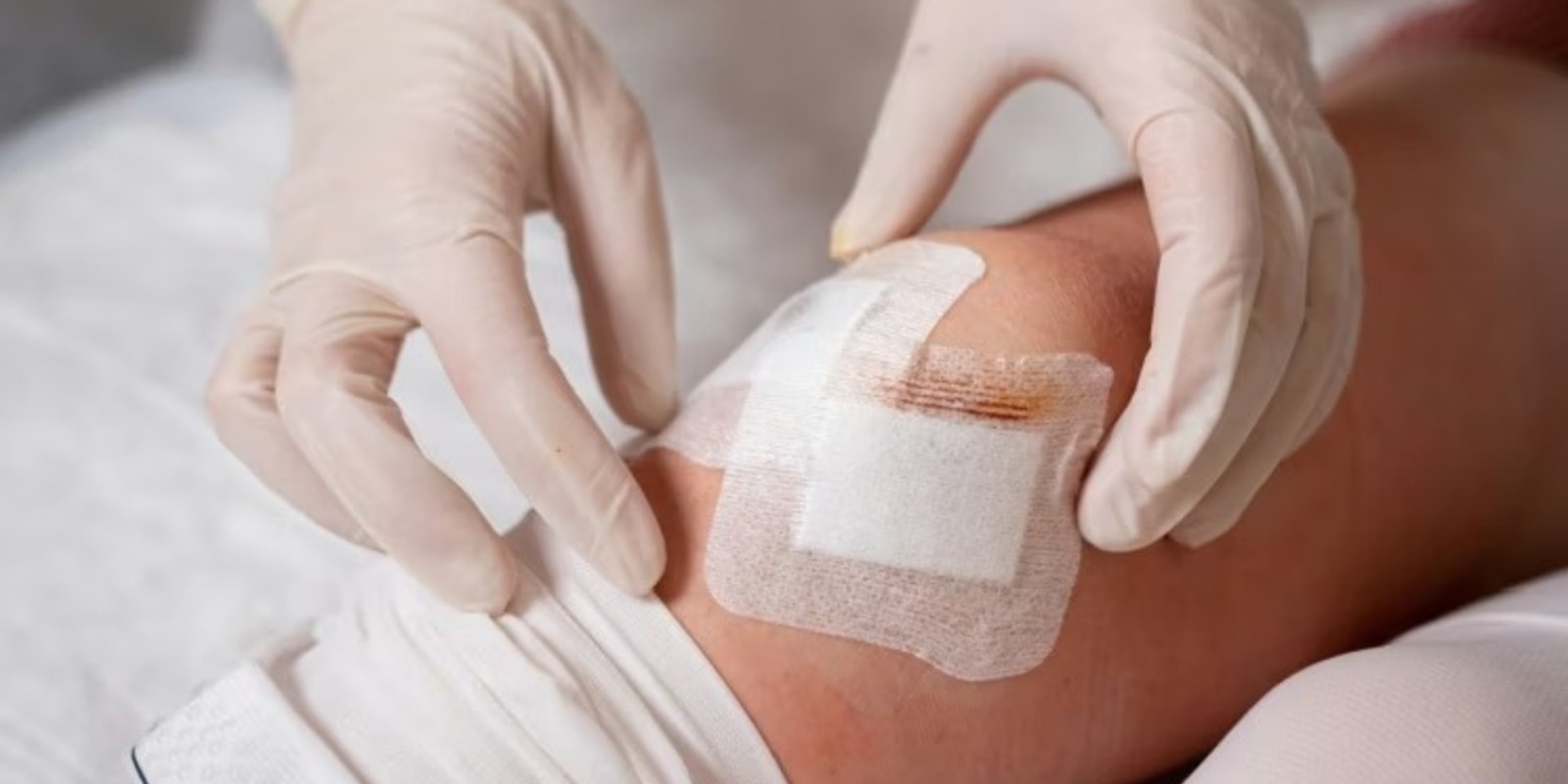 10 Signs of Wound Infection & When to Call a Nurse at Home in Dubai