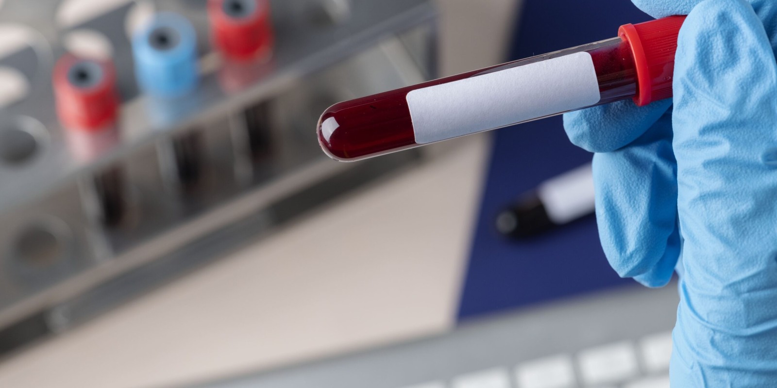 How Much Do Blood Tests at Home Cost in Dubai? A Simple Guide