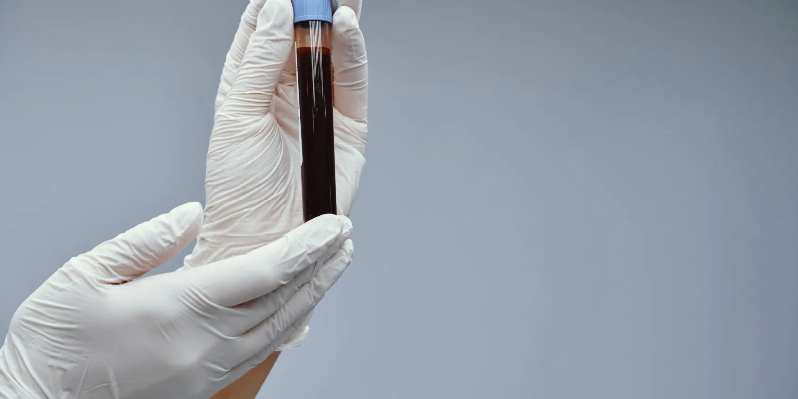 Getting Blood Tests at Home in Dubai: What You Can Check and How It Works