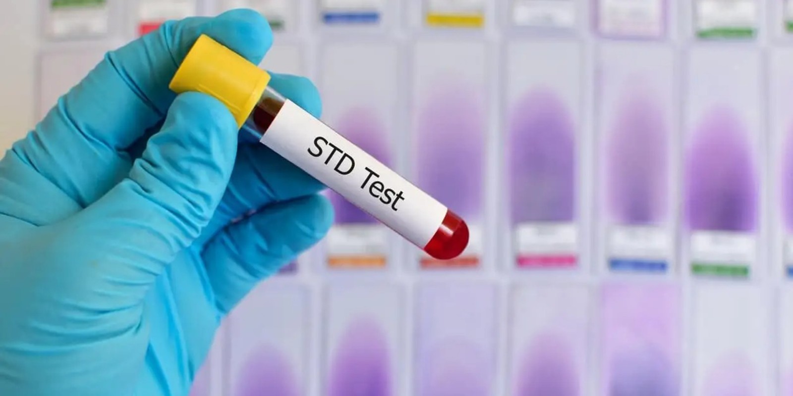 What’s Included in an STD Test in Dubai? A Clear Guide to Screening & Parameters