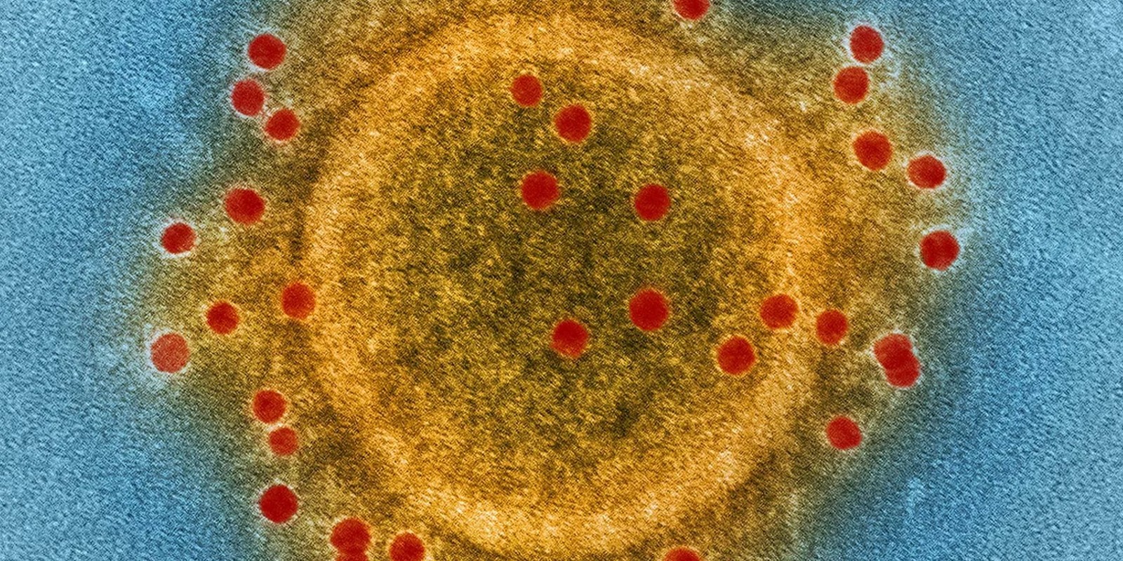MERS Virus in Dubai: Causes, Symptoms & How to Stay Protected