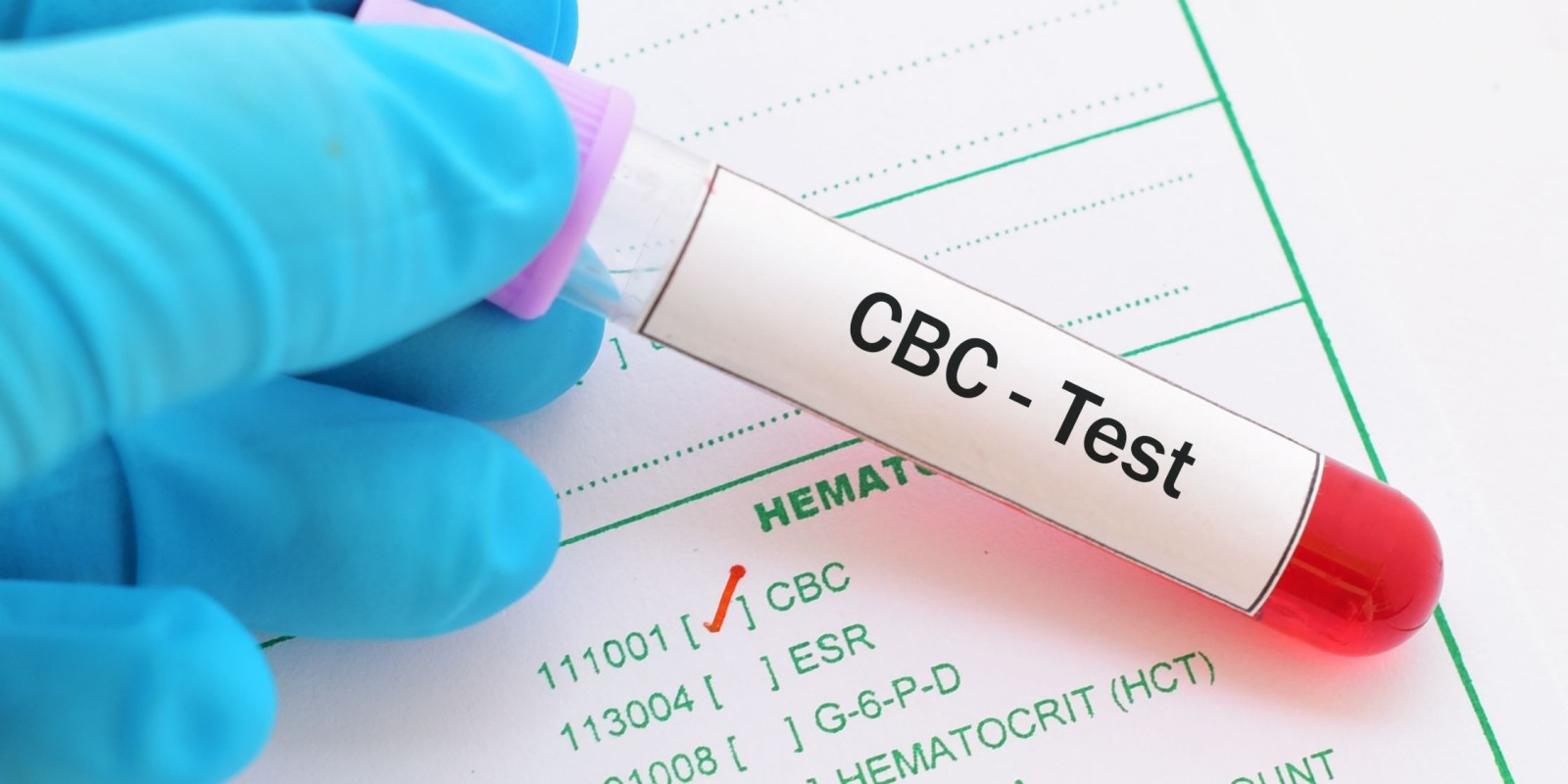 CBC Test Explained: What a Complete Blood Count Reveals About Your Health