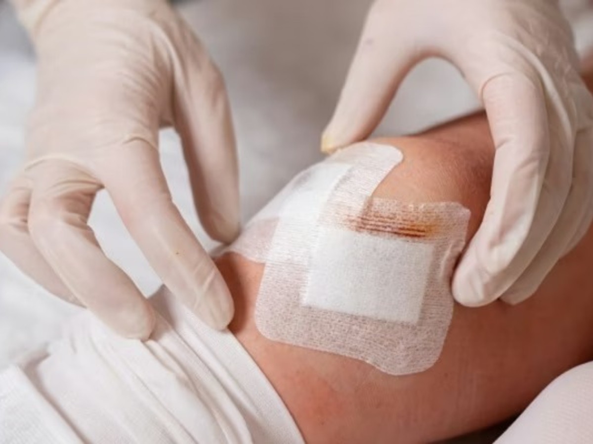 10 Signs of Wound Infection & When to Call a Nurse at Home in Dubai