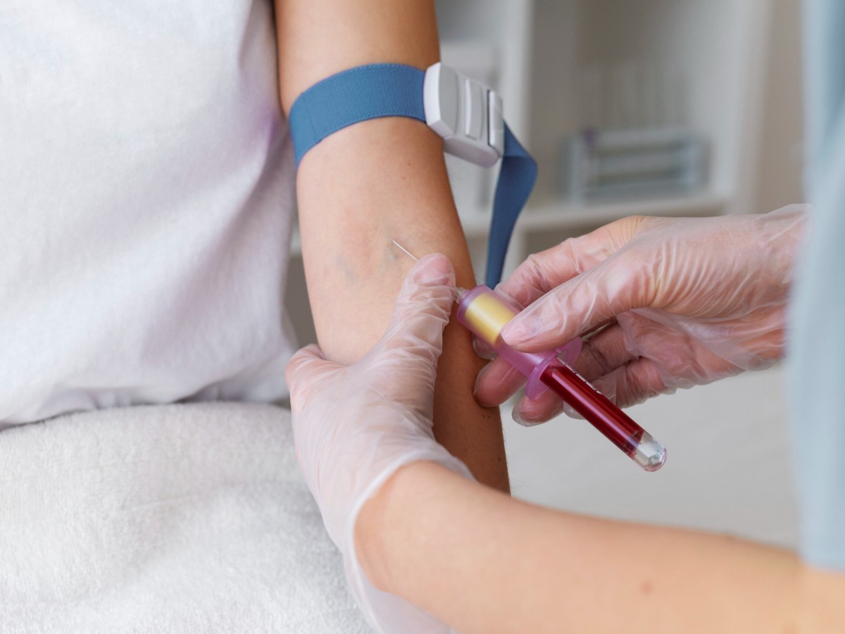 5 Common Mistakes to Avoid Before Getting a Blood Test at Home in Dubai