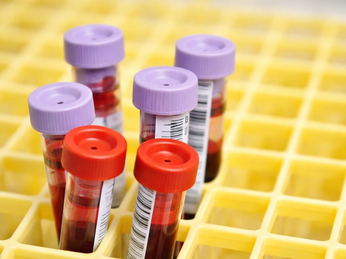 Why Annual Blood Tests Are Essential for Your Health in Dubai