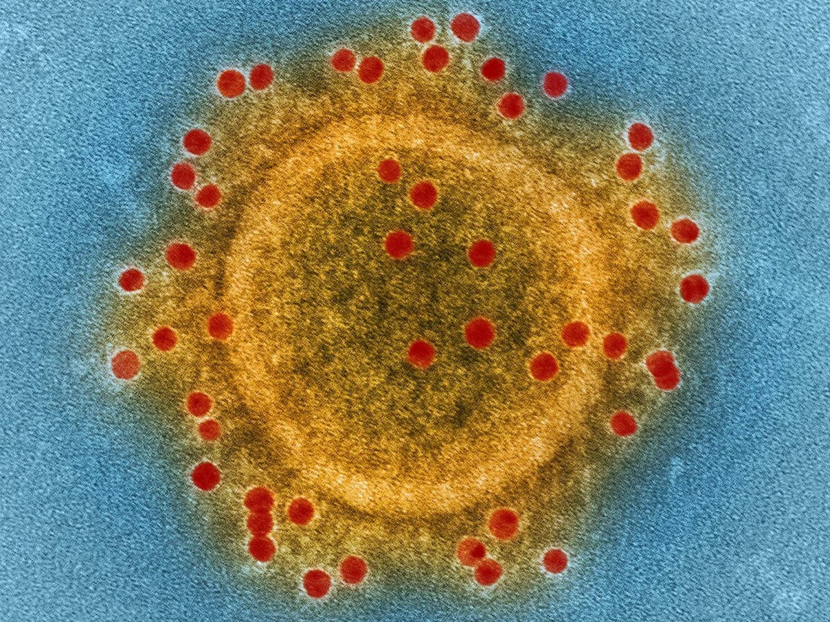 MERS Virus in Dubai: Causes, Symptoms & How to Stay Protected